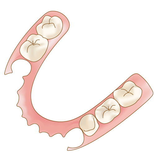 【イラストで紹介】特殊な樹脂で作った入れ歯