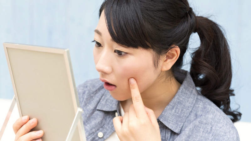 「えーっ、またココに！？」 どうしてニキビは同じ場所にできるの？