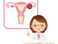 卵巣のう腫の治療 …手術で摘出しても妊娠できる？
